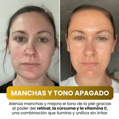 JAYNA MASCARILLA NOCTURNA: Tu Renacimiento Facial Antiedad 100% Efectivo