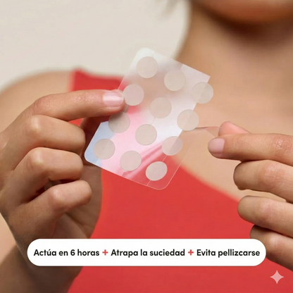 MIGHTY PATCH: Ciencia para tu piel - Tu granito no sobrevivirá a la noche 100% efectivo